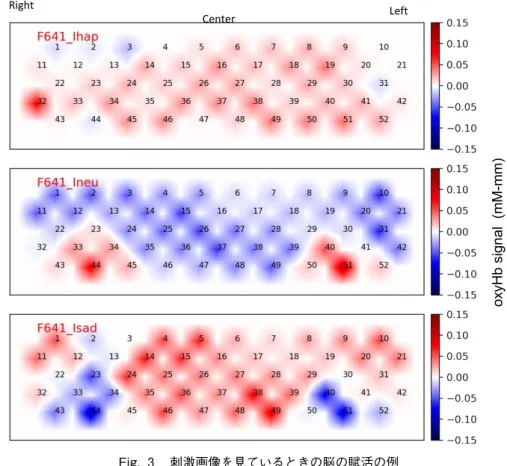 Fig. 3  刺激画像を見ているときの脳の賦活の例