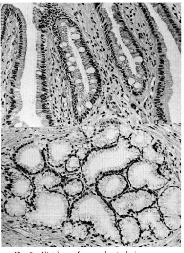 Tab. 3 Relationship between thickness of the gallbladderwall and intimal thickening of the cystic artery