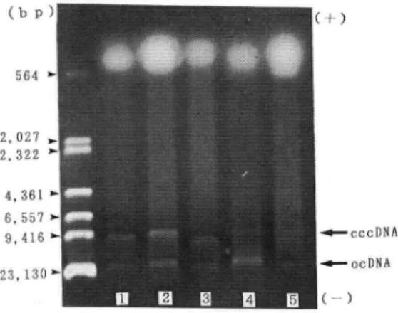 Fig.  2.  Agarose  gel  electrophoretic  patterns  of mtDNA  prepared  from  preserved  livers.