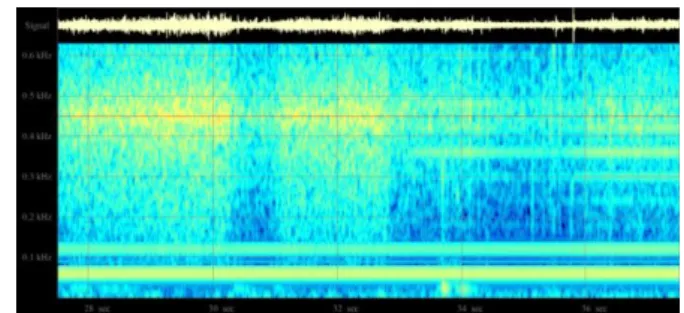 Fig.  (1).  Fourier  analysis  of  myoelectric  signals  by  using 