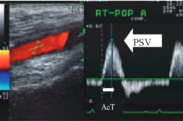 Fig. 2    Doppler  display  （ left: color Doppler ,  right: 