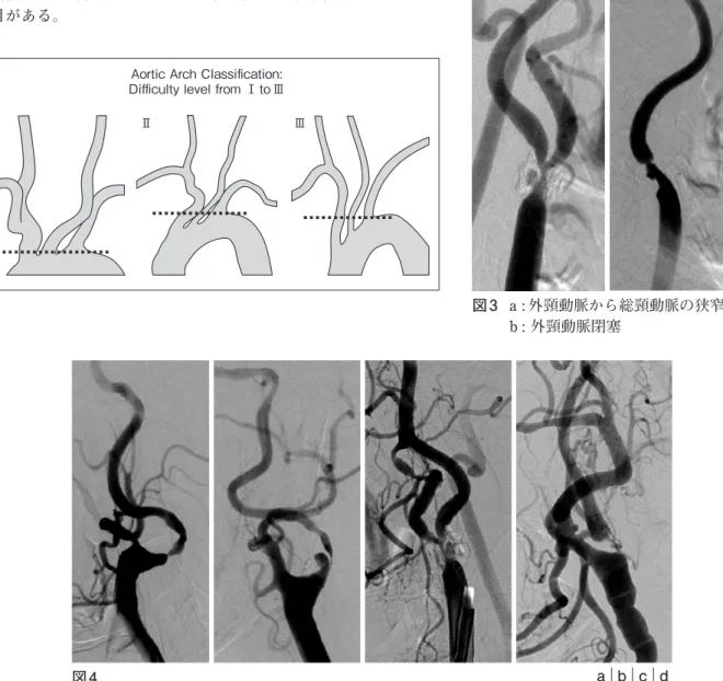 図 2  図 3  a : 外頸動脈から総頸動脈の狭窄