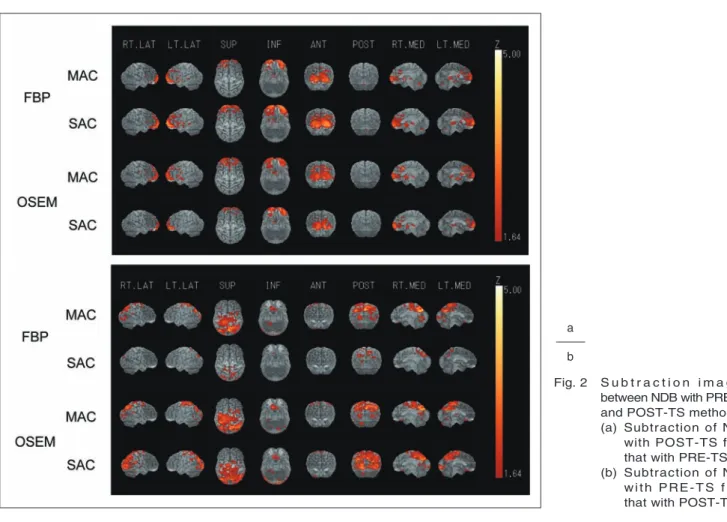 Fig. 2  S u b t r a c t i o n   i m a g e s  between NDB with PRE-TS  and POST-TS method.