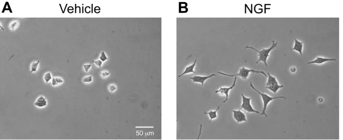 Fig. 3  Morphological changes by NGF-induced neurite outgrowth in PC12 cells. 