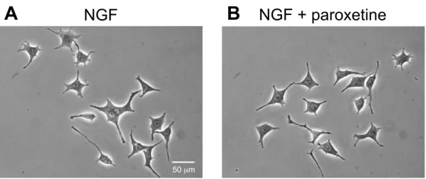 Fig. 7  Morphological changes by paroxetine on NGF-induced neurite outgrowth    in PC12 cells
