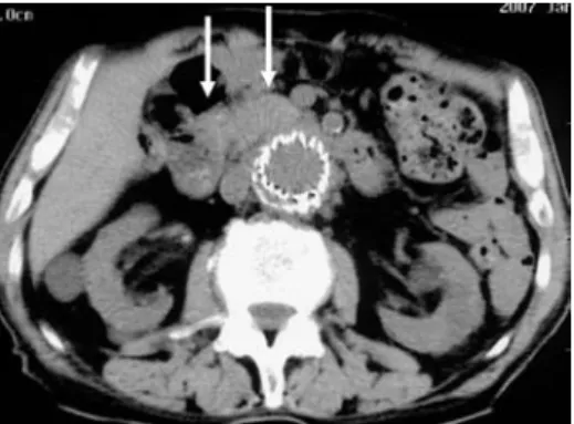 Figure 6 Operative procedure of case 2.