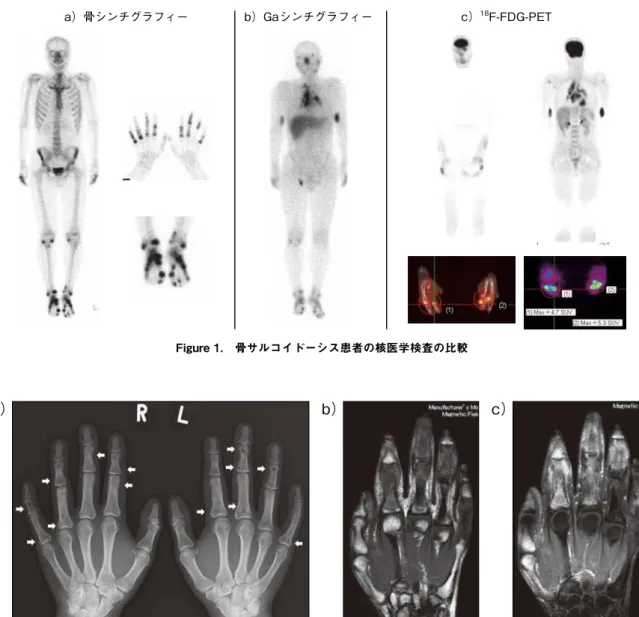 Figure 1.   骨サルコイドーシス患者の核医学検査の比較