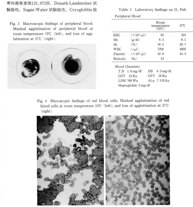 Fig.  3  Macroscopic  findings  of  peripheral  blood. 