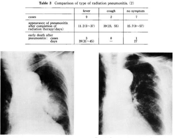 Fig.  lb  Reticular  shadow  type  Chest  X-ray.  A reticular  shadow  was  only  observed  in  the   radiat-ed  left  lung