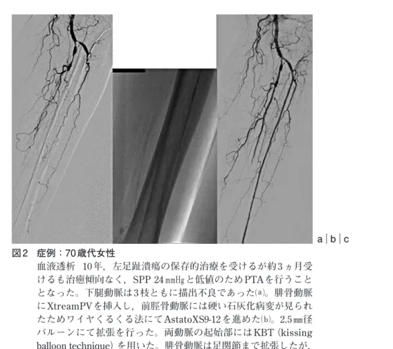 表 1  当院での PTA 成功率の年次変化