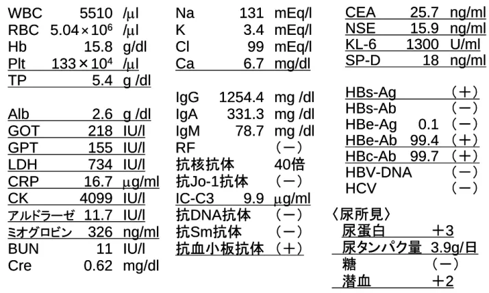 表  1  血液検査所見  WBC 5510 /μl RBC 5.04 × 10 6 /μl  Hb 15.8 g/dl Plt 133×10 4 /μl TP 5.4 g /dl Alb 2.6 g /dl GOT 218 IU/l GPT 155 IU/l LDH 734 IU/l CRP 16.7 μg/ml CK 4099 IU/l アルドラーゼ 11.7 IU/l ミオグロビン 326 ng/ml BUN 11 IU/l Cre 0.62 mg/dl Na 131 mEq/lK3.4 mEq/lC