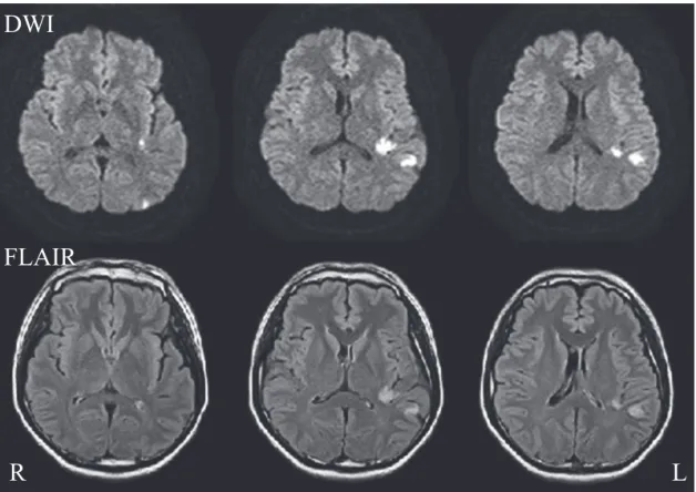 Fig. 4　Clinical course of case 2.