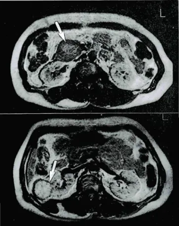 Fig. 2 Macrophotographs of the cut surface of islet cell