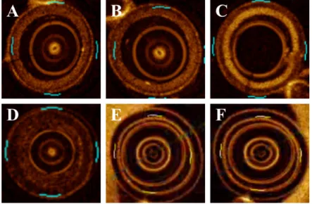 Fig. 2.2 Examples of different catheter shape types. (A)-(C) shows concentric circular rings with distortion; (D) represents a regular catheter but with a different thickness of rings