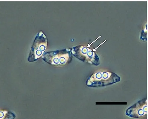 Fig. 1.  Fresh mount of spores of Ceratomyxa sp. from gall-bladder of inshore hagfish