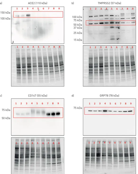 FIGURE 5 Immunoblot analysis of ACE2 (angiotensin-converting enzyme 2), TMPRSS2, CD147 and GRP78 protein expression in human airway epithelial cell protein lysates