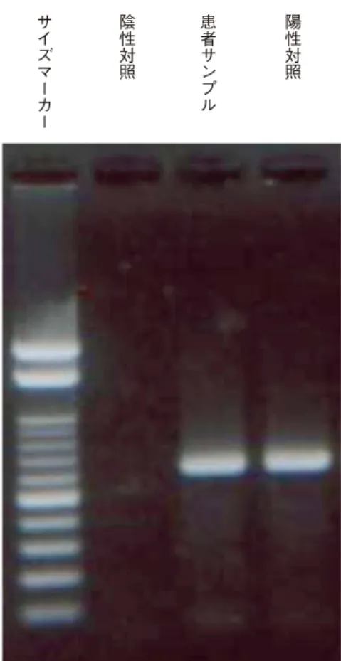 図 49 Polymerase chain reaction(PCR)産物のアガ ロースゲル電気泳動．