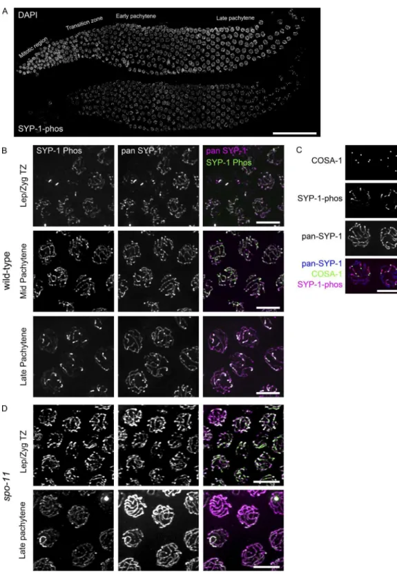 Figure 2.  Phosphorylated SYP-1 localizes to the entire SC in early prophase and then becomes progressively restricted to the short arm