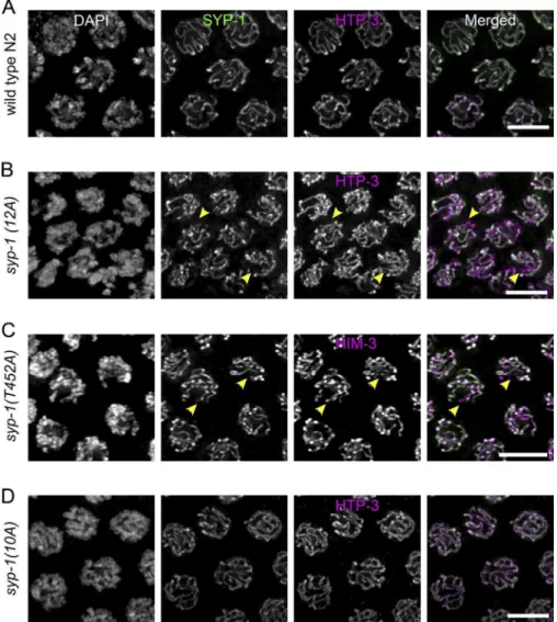 Figure 4.  Phosphorylation of SYP-1 is re- re-quired for timely completion of synapsis