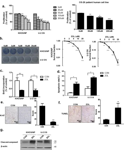 Figure 1. Zoledronic acid (ZOL) inhibited osteosarcoma (OS) cell proliferation. (a) Cell viability was  evaluated by MTT assay in KHOS/NP cells, U2OS cells of OS cell lines and cells from a patient with Figure 1.Zoledronic acid (ZOL) inhibited osteosarcoma