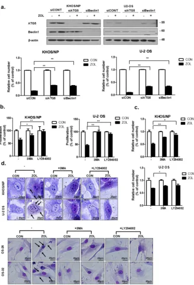 Figure 4. Inhibition of autophagy repressed the anti-proliferative effect of zoledronic acid (ZOL) in  osteosarcoma (OS) cells
