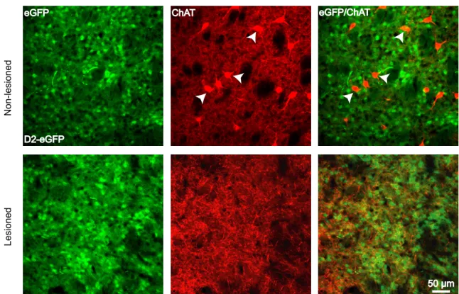 Figure 2. 5 Histological verification of specific lesion of ChIs in transgenic  mice striatum