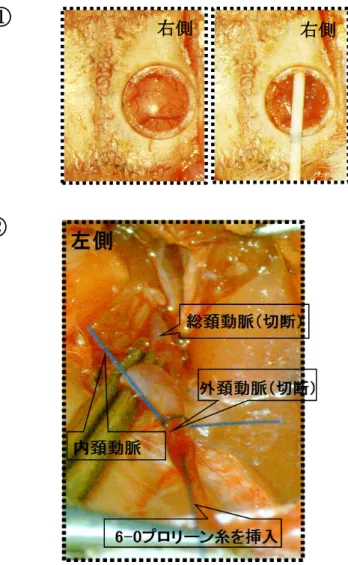 図 5: endovascular perforation (EVP)  モデルの作成方法