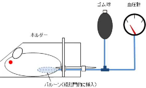 図 2 C olorectal di stension (CR D)   負 荷 装 置 の 概 略 図