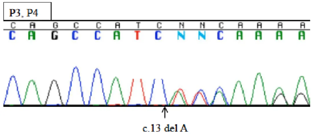 図 4   P3 および P4 の PTEN 遺伝子の DNA シークエンス波形 矢印が患者の PTEN 遺伝子変異部位を示す。    