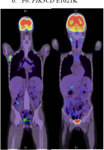 図 9 18F-fludeoxyglucose を投与した後撮影された P1 および P6 の PET 画像。 a.  P1 において、頸部、腹腔内リンパ節および脾臓組織へのグルコース取り 込み亢進が認められる。 b
