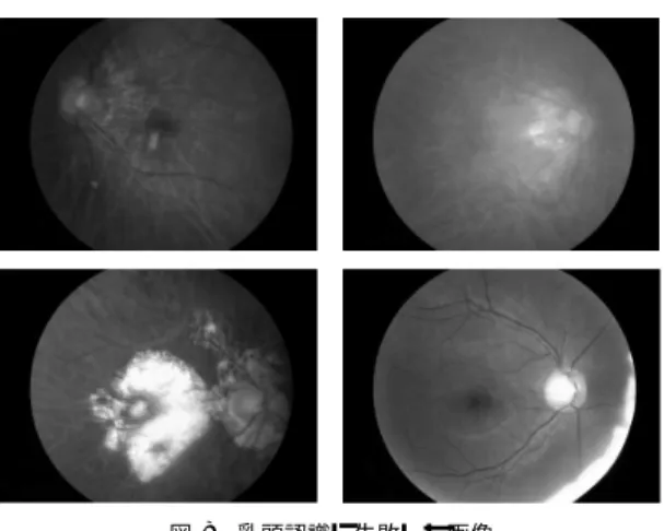 表 2 各手法における視神経乳頭の認識結果 Table 2 Recognition results of optic nerve heads in