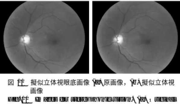 Fig. 9 Result of optic nerve head recognition. (a) Original image, (b) Result with using original image, and (c) Result with using  blood-vessel-eliminated image.