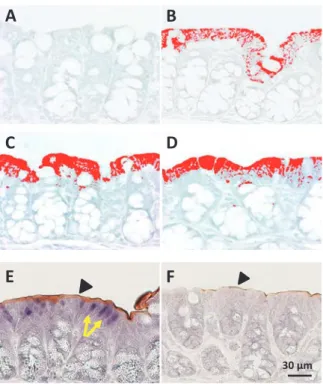 図 6　in vivo エレクトロポレーション法による ERb siRNA 導 入マウス大腸での Na + /H + 交換輸送体 -3（NHE3）発現の変化（文 献 11 より改変）．（A–D）ERb アンチセンスプローブを用いて in situ hybridization を行い，画像処理システムを用いて ERb の mRNA の発現を解析したもの．（A）妊娠マウス大腸 5 日，（B）