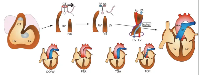 Fig. 3   Development and defects of the cardiac outflow tract. See detail in the text