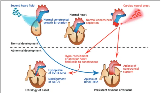 Fig. 5   Normal and abnormal development of the second heart field and the cardiac neural crest