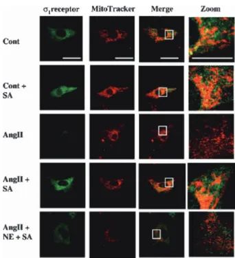 Fig. 2. Intracellular Localization of Sigma-1 Receptor fol- fol-lowing Treatment with Ang II and SA4503