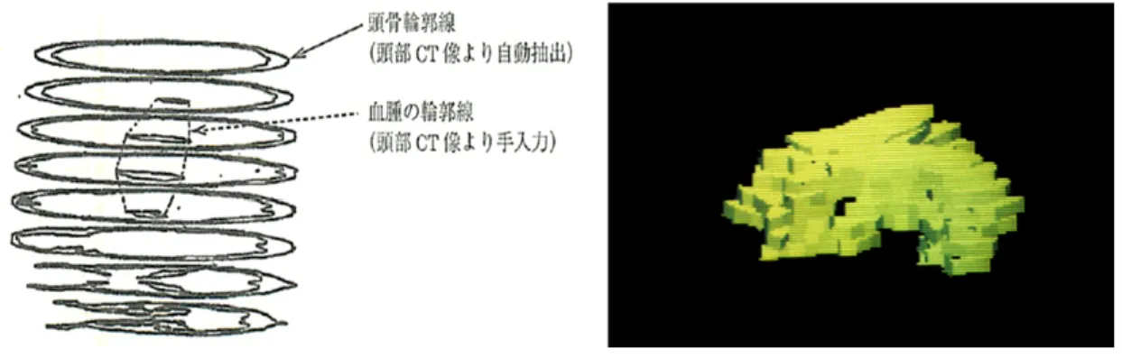 図  ２  3 次元構造の可視化の初期の例  左は輪郭線を相対的に位置を合わせて書いたでけ、