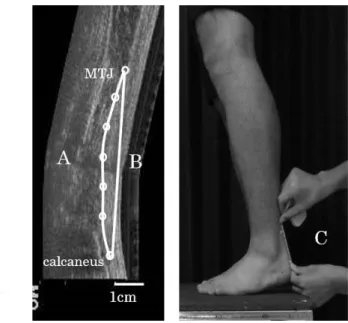Figure 2. The calculation of Achilles tendon length (L AT ). 