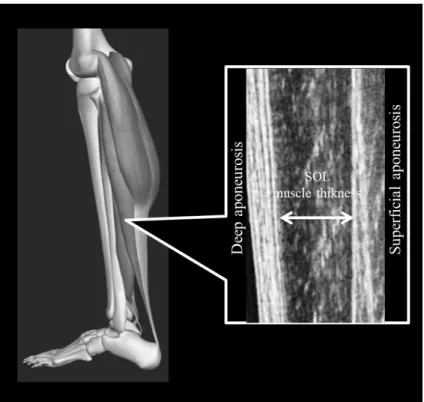 Figure 3. Measurement schema for soleus muscle thickness . 