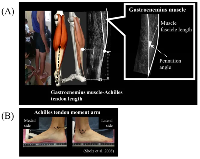 Figure 2. Schematic illustrations of the musculoskeletal measurements. 