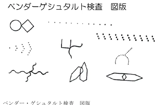 図 5  ベンダー・ゲシュタルト検査  図版 