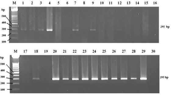Figure  5.  PCR  products  from  homogenate  tonsils  for  detection  of  M. 