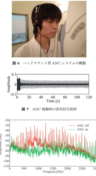 図 5 ベッドに導入されたいびき用 ANC の外観図 を撮像可能であるなどの利点がある．しかし，一方で非常 に大きく且つ耳障りな騒音 (MRI 騒音 ) が発生するという 短所がある．よって，患者や医療スタッフは長時間に渡っ て MRI 騒音に曝されることになり，さらには，患者やス タッフ間での肉声による会話が困難になるという問題があ る．そこで MRI 騒音の低減のために ANC を利用するこ とが検討されてきている． ANC による MRI 騒音の低減の 試みは多くなされており [15–18] ， 30