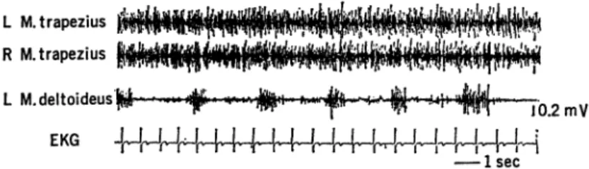Fig. 0 Ranges and median levels of the electromyographic activity in percent maximum contraction during operations of various o $ ce machine