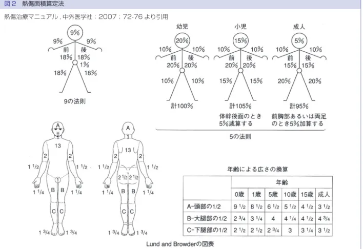 図 2 熱傷面積算定法