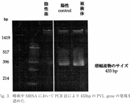 Fig. 4  骨盤部 MRI 検査（Fig. 4a）では T2 強調画像で右大腿骨頭を中心とした高 信号を認め，また周囲の筋組織への炎症の波及と思われる高吸収域も認め た．ガリウムシンチ検査（Fig. 4b）では右大腿部に集積を認めた．