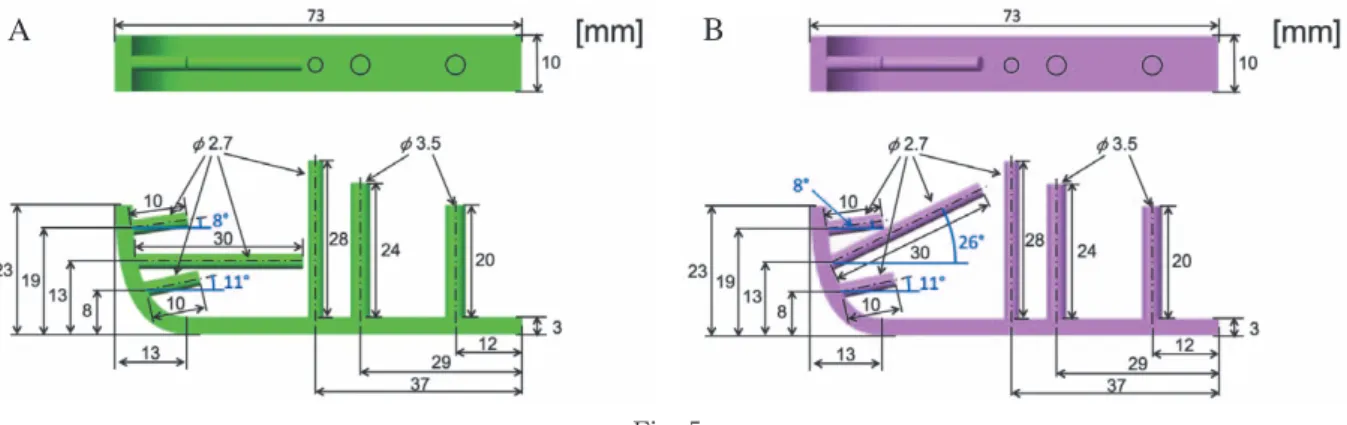 Fig. 5 A：  髄内スクリューモデル．近位から 2 穴目のスクリューを髄腔と水平にスクリューを挿入したモデルを作成した． B：  軟骨下骨スクリューモデル．軟骨下骨を通るように上方に角度をつけてスクリューを挿入したモデルを作成した． Fig. 6 プレート・スクリュー装着モデル 肘頭モデルとプレート・スクリューモデルをブーリアン操 作により，スクリュー・プレート装着モデルを作成した． スクリュー固定部と尺骨を剛体結合として接触条件を設 定した（青線）．骨折部のヤング率を 1 MPa と設定した． Fi