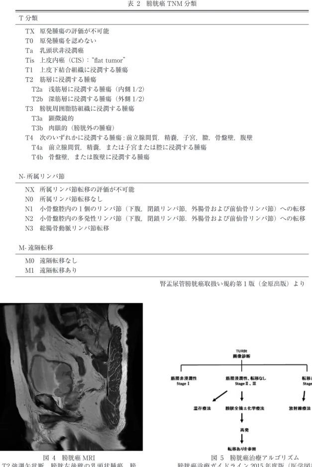 表 2 膀胱癌 TNM 分類 T 分類