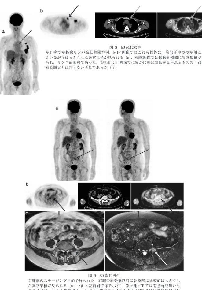 図 9 80 歳代男性