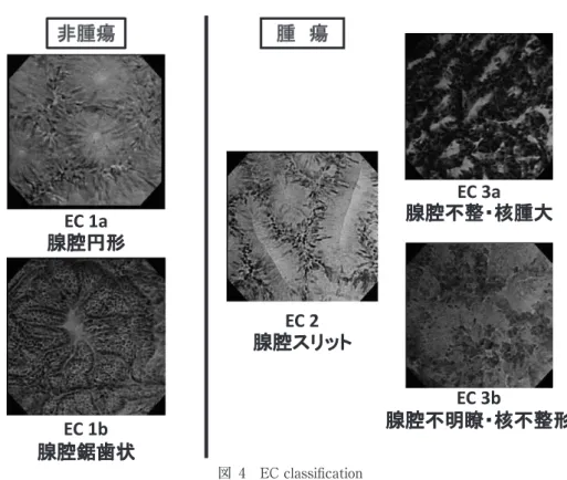 表 4　EC classiﬁcation and pathological diagnosis